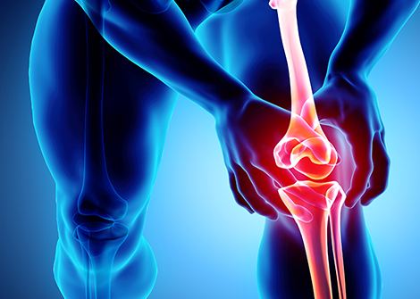 Knee Osteoarthritis And Robotic Knee Replacement Surgery