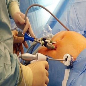 <small>Gastroenterology and Gastrointestinal & HPB Surgery</small>
