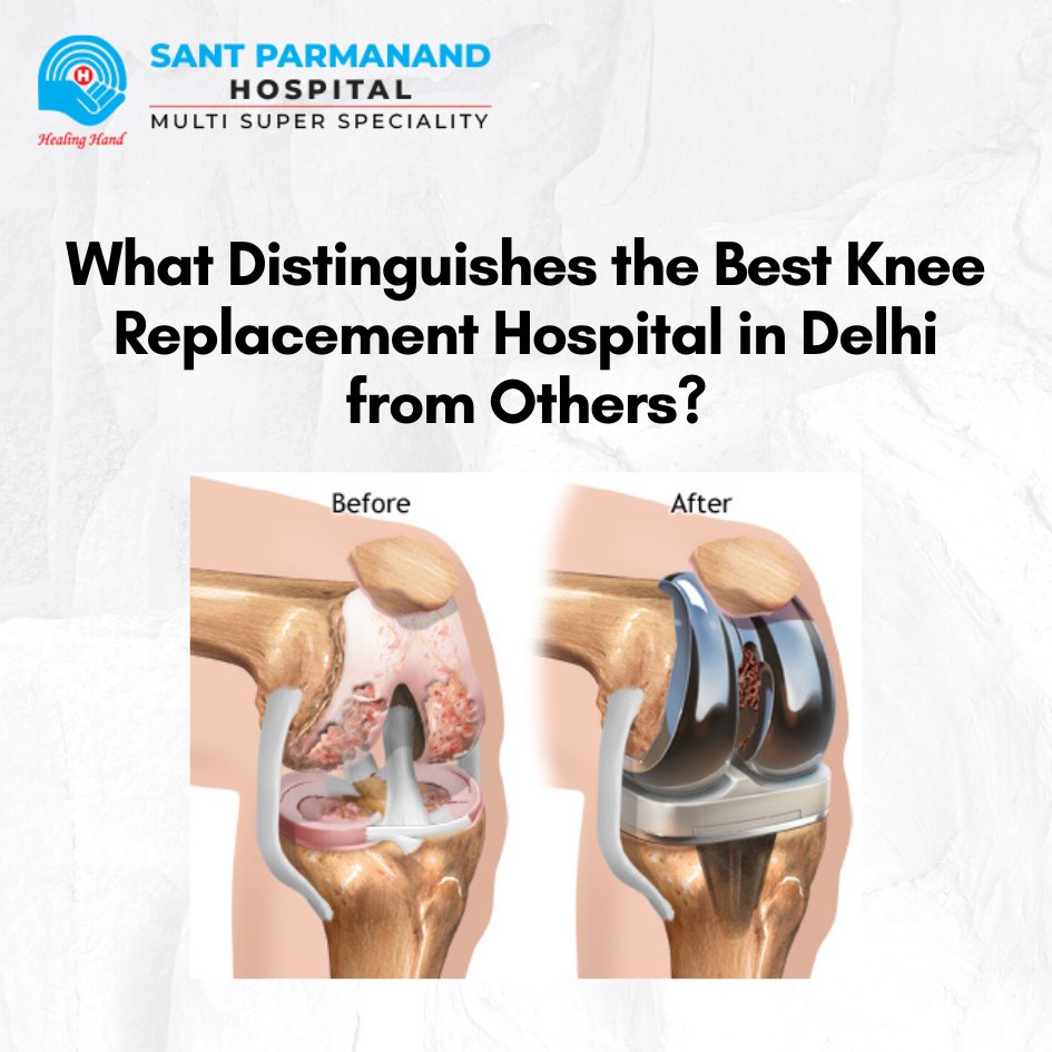 What Distinguishes the Best Knee Replacement Hospital in Delhi from Others?