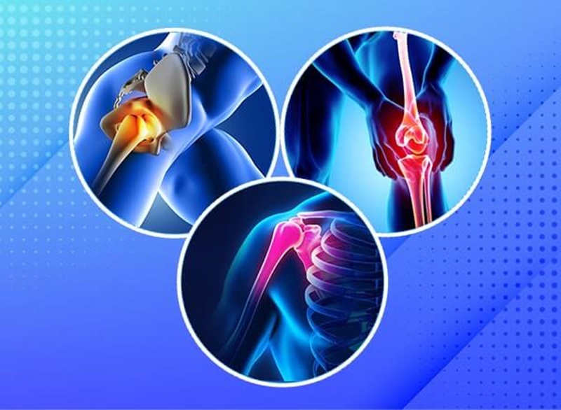 What is Osteoarthritis?