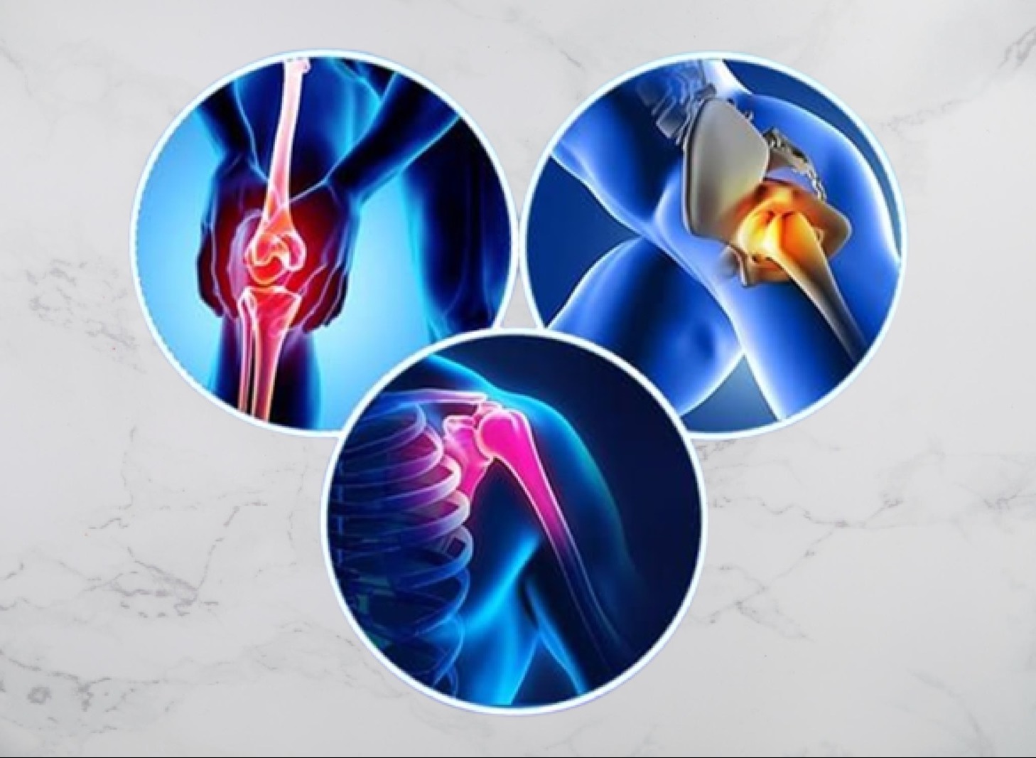 What is Osteoarthritis?