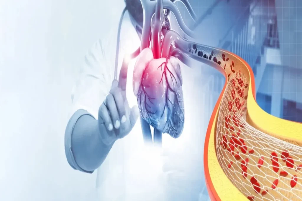 interventional cardiologist in Delhi