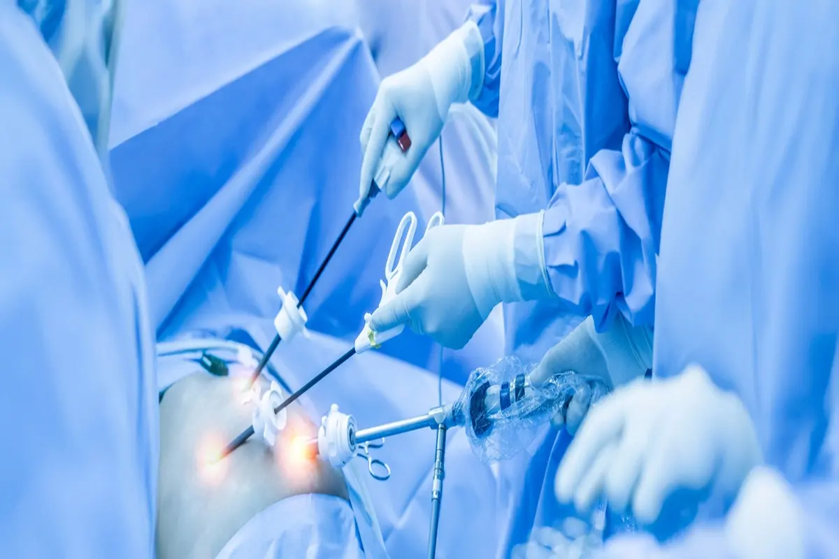 How Advanced Laparoscopic Techniques Are Changing Surgery Outcomes in Delhi NCR ?