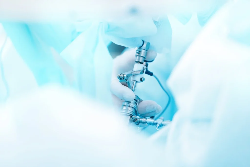 minimally invasive surgery