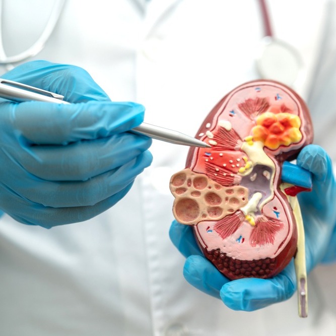 Kidney Care with Dialysis