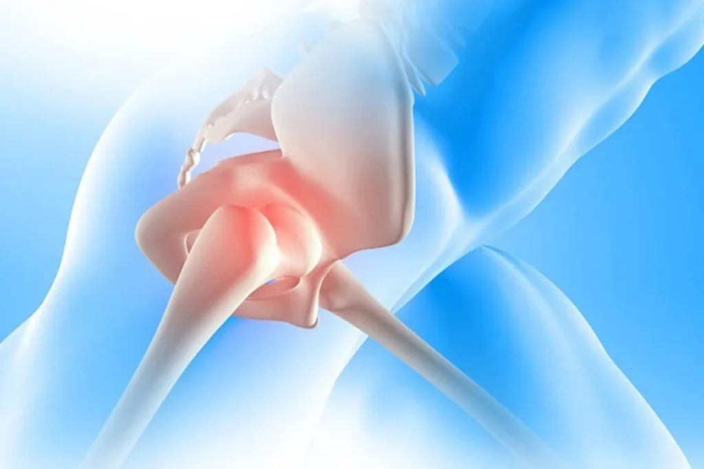 Hip Replacement Surgery During Summer Months