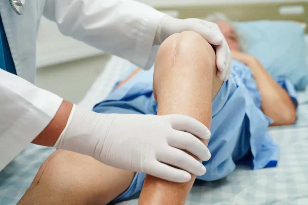 What is Total Knee Replacement Surgery