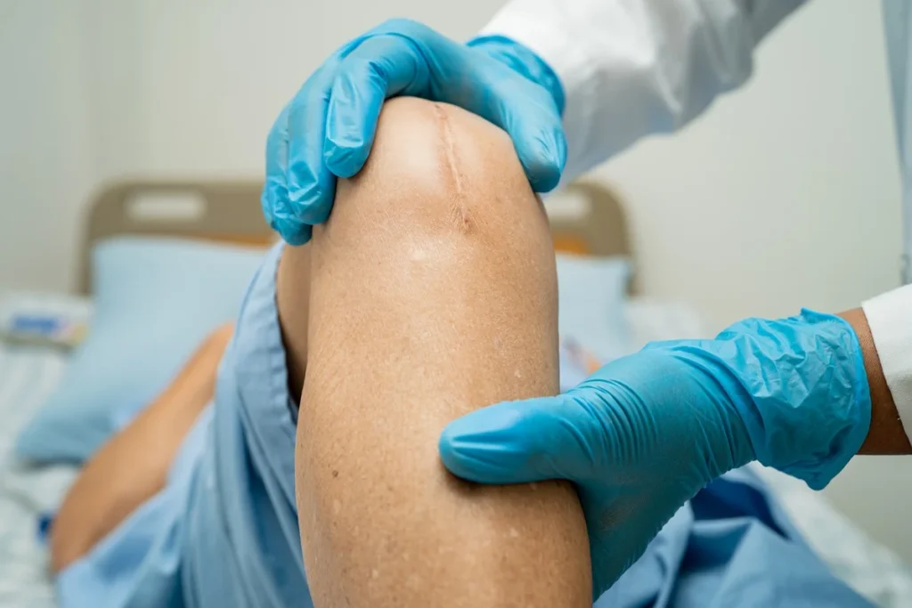 Knee hospital Delhi